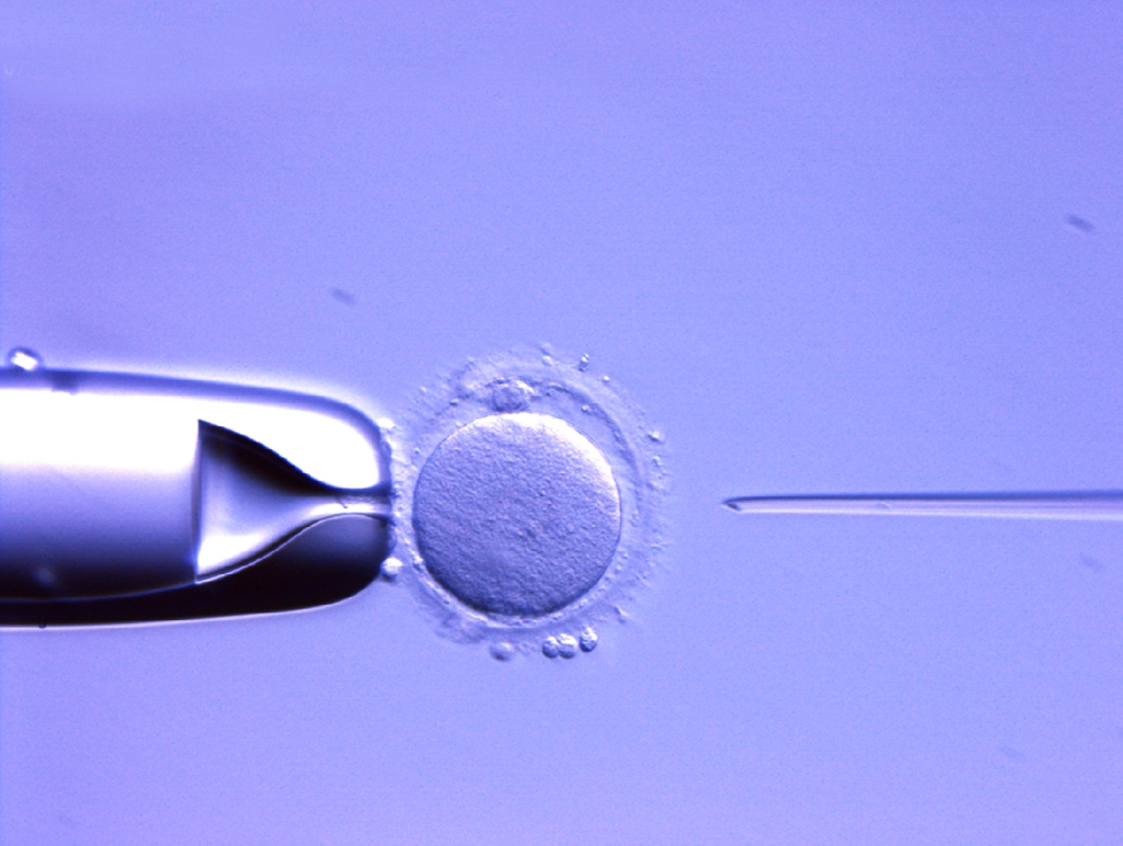 Tratamientos de fertilidad